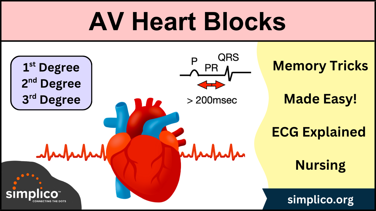 Heart Block Poem: 1st, 2nd, 3rd Degree Types and ECG Rhythm Explained