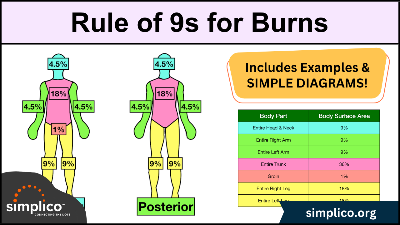 Rule of Nines for Burns: Child &amp; Adult Chart Calculations