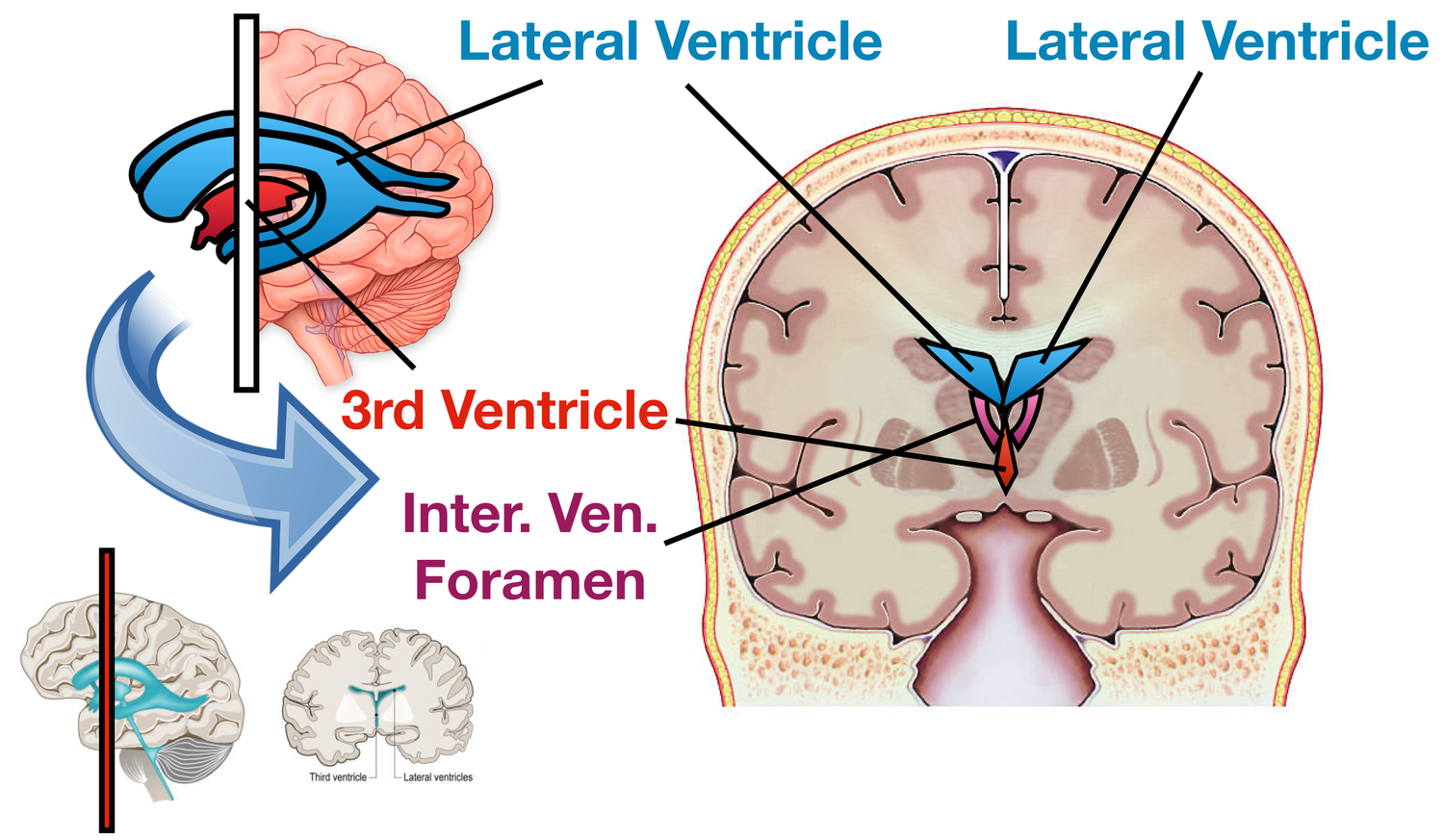 Ventricles of the Brain: Anatomy, Function, Labeled Diagram, Location ...