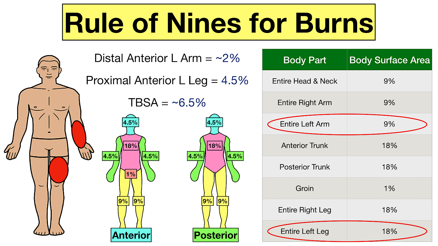 rule of nines for burns example and practice problem question quiz