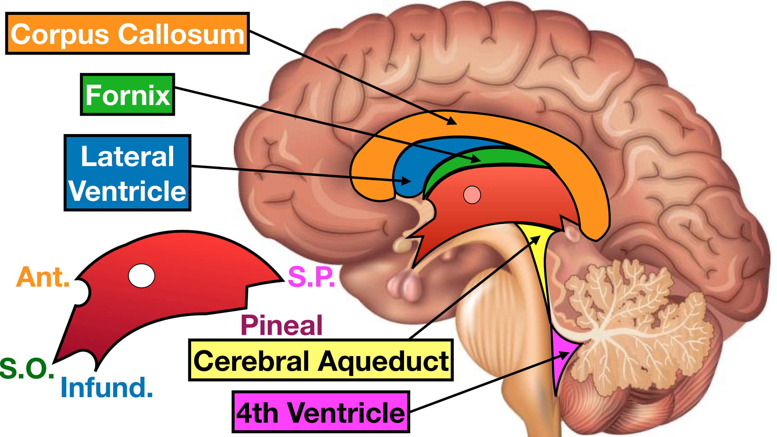 Image (Sagittal View): Location of the third ventricle and its associated recesses.