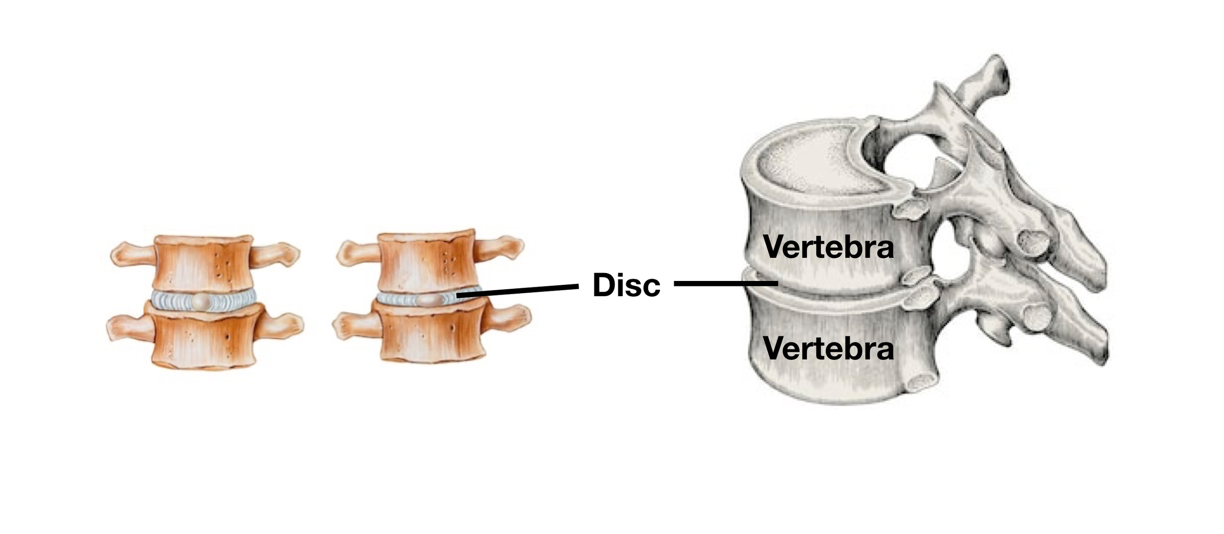 Image: Intervertebral discs are located between each mobile vertebra, with the exception of C1 and C2, and they prevent the vertebral bodies from rubbing together.
