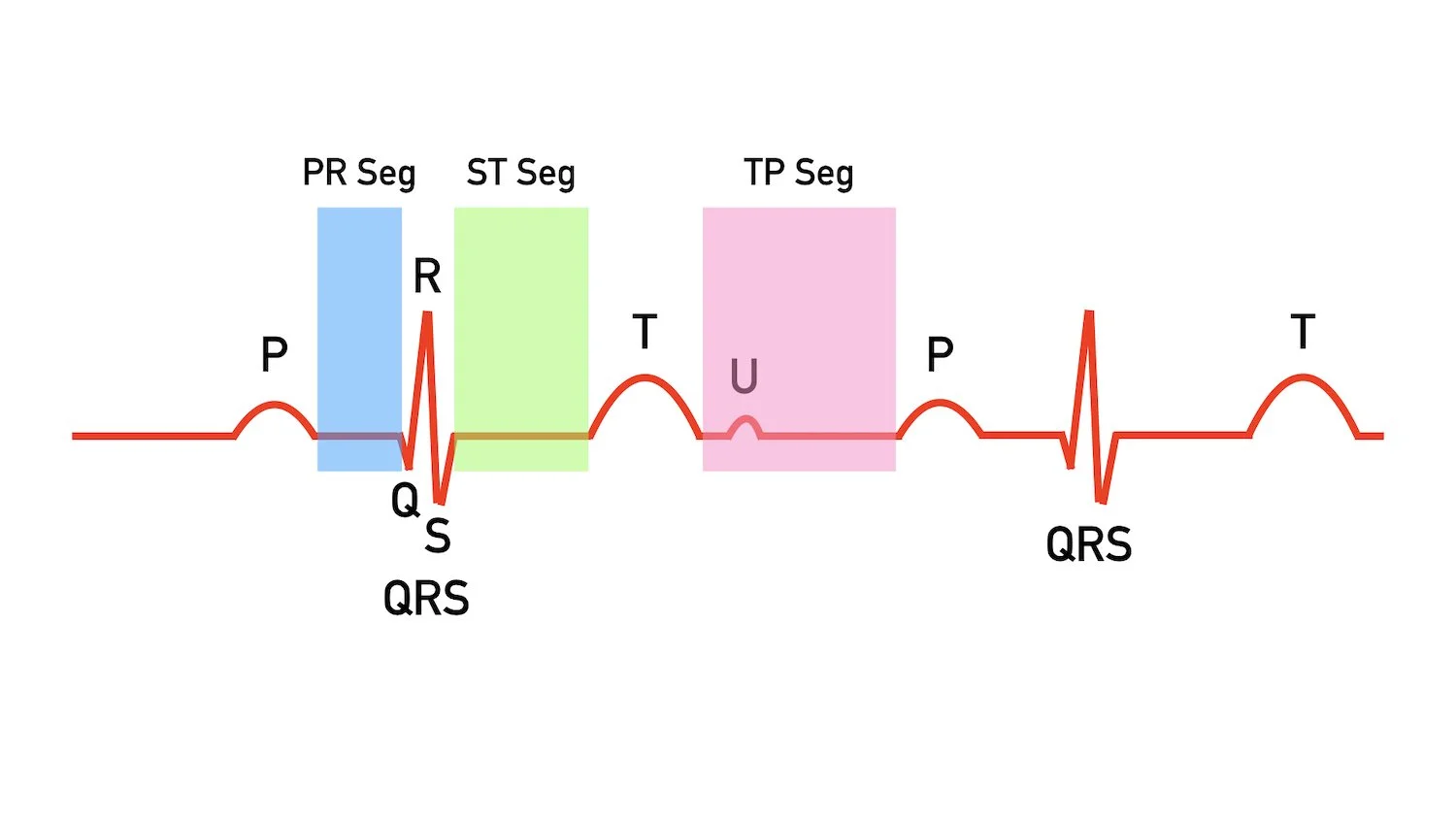 ecg ekg wave explained labeled components diagram pr st tp segment