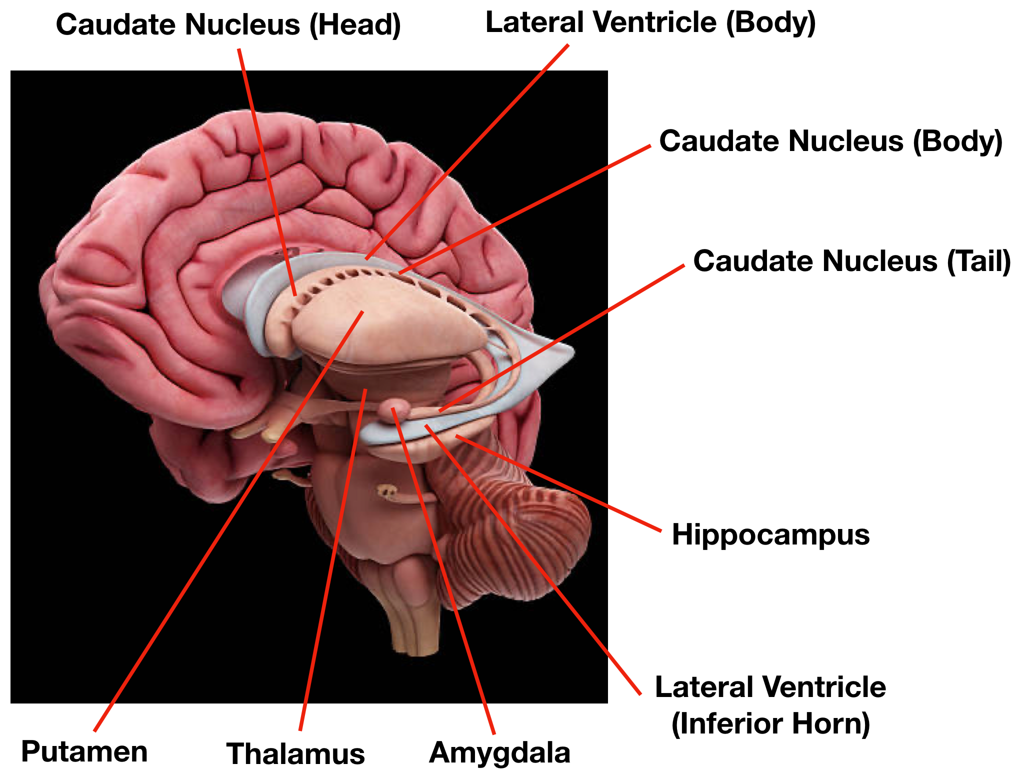 Image (Sagittal View): Appreciate the relationship between the lateral ventricle, caudate nucleus, and thalamus. The body of the caudate nucleus and the thalamus form the floor/lateral wall of the body of the lateral ventricle.