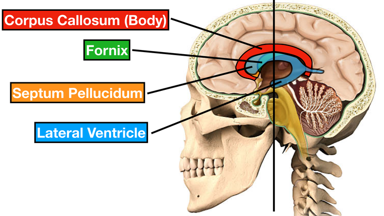 Ventricles of the Brain: Anatomy, Function, Labeled Diagram, Location ...