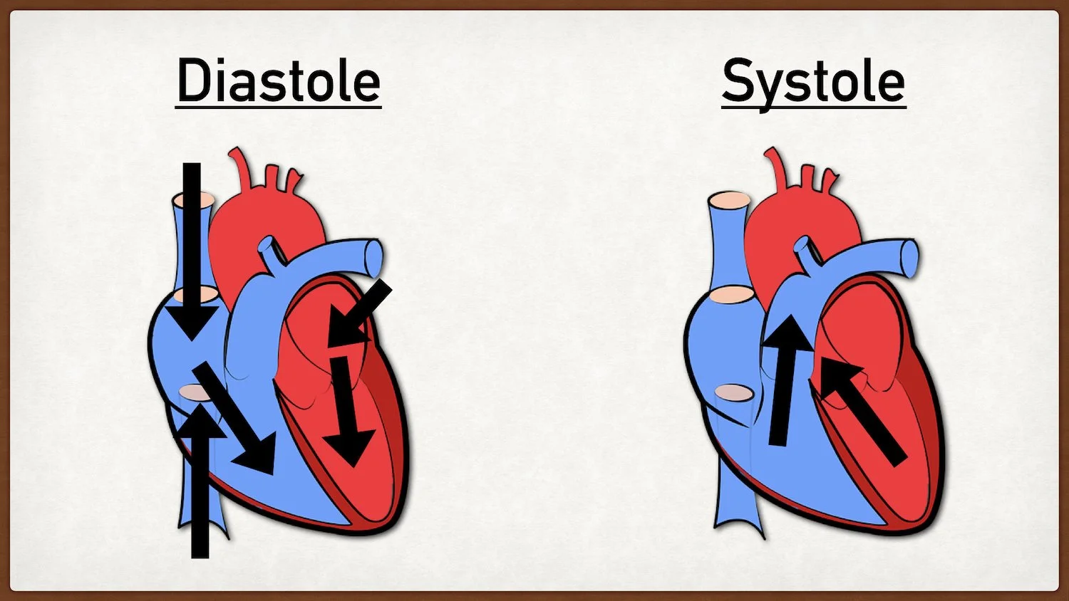 Diastole: The phase in which the heart, especially the ventricles, are at rest allowing the cardiac chambers to fill with blood.Systole: The phase in which the heart, especially the ventricles, are contracting and pushing blood forward into the pulm…