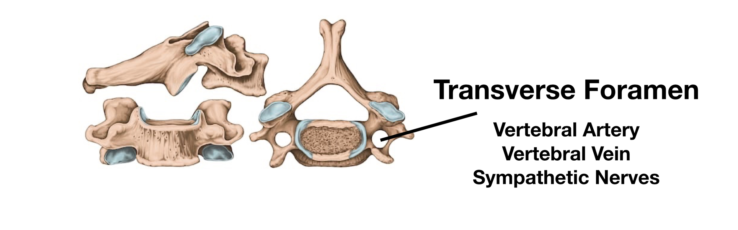 Image: The cervical vertebrae have 2 transverse foramina that allow for passage of the vertebral artery, vertebral vein, and sympathetic nerves.