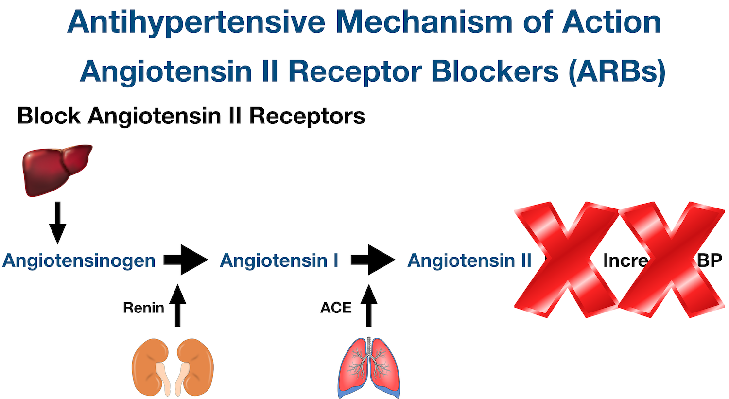 ARB Mechanism of Action: Blocks angiotensin II receptors, which blocks the downstream effects of angiotensin II
