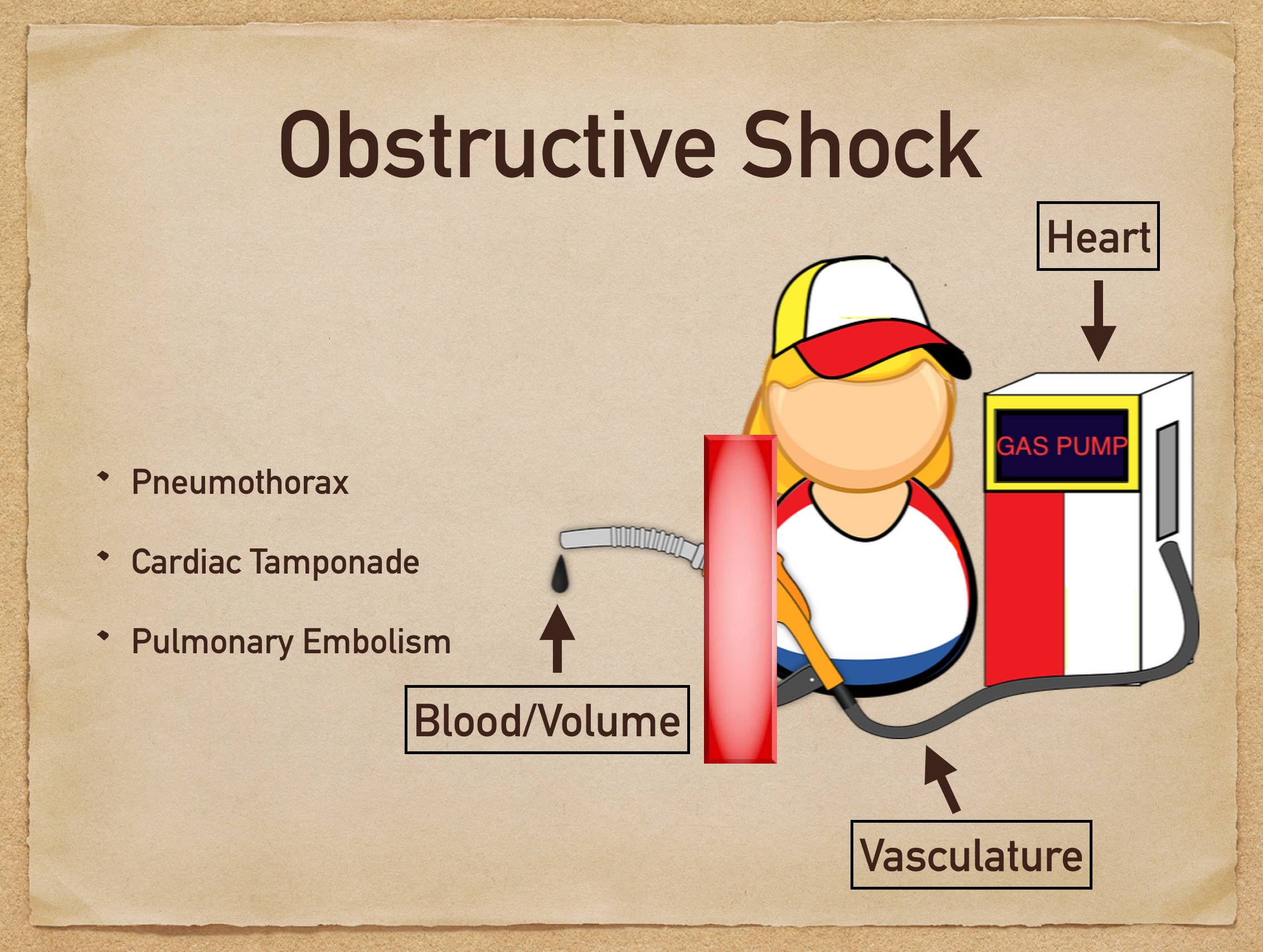 obstructive shock