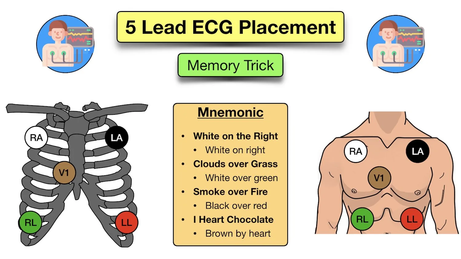 5 lead ecg placement acronym mnemonic electrodes smoke over fire
