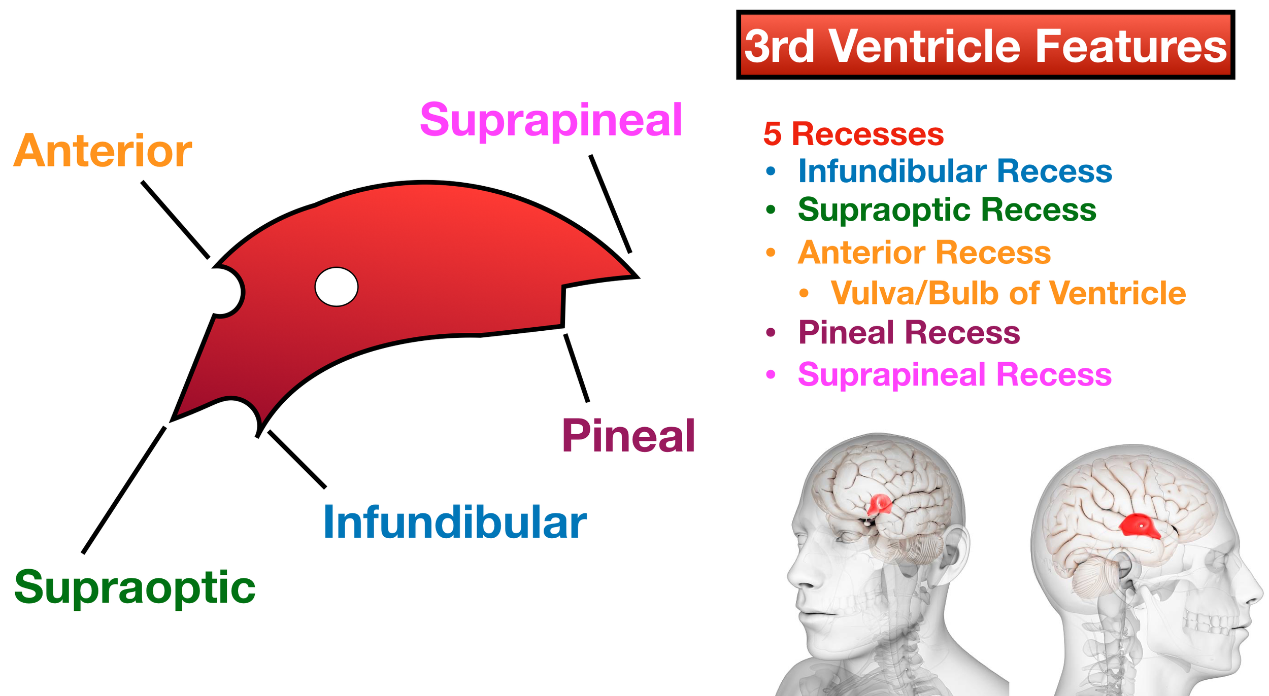 Image (Sagittal View): The 5 main recesses of the third ventricle.