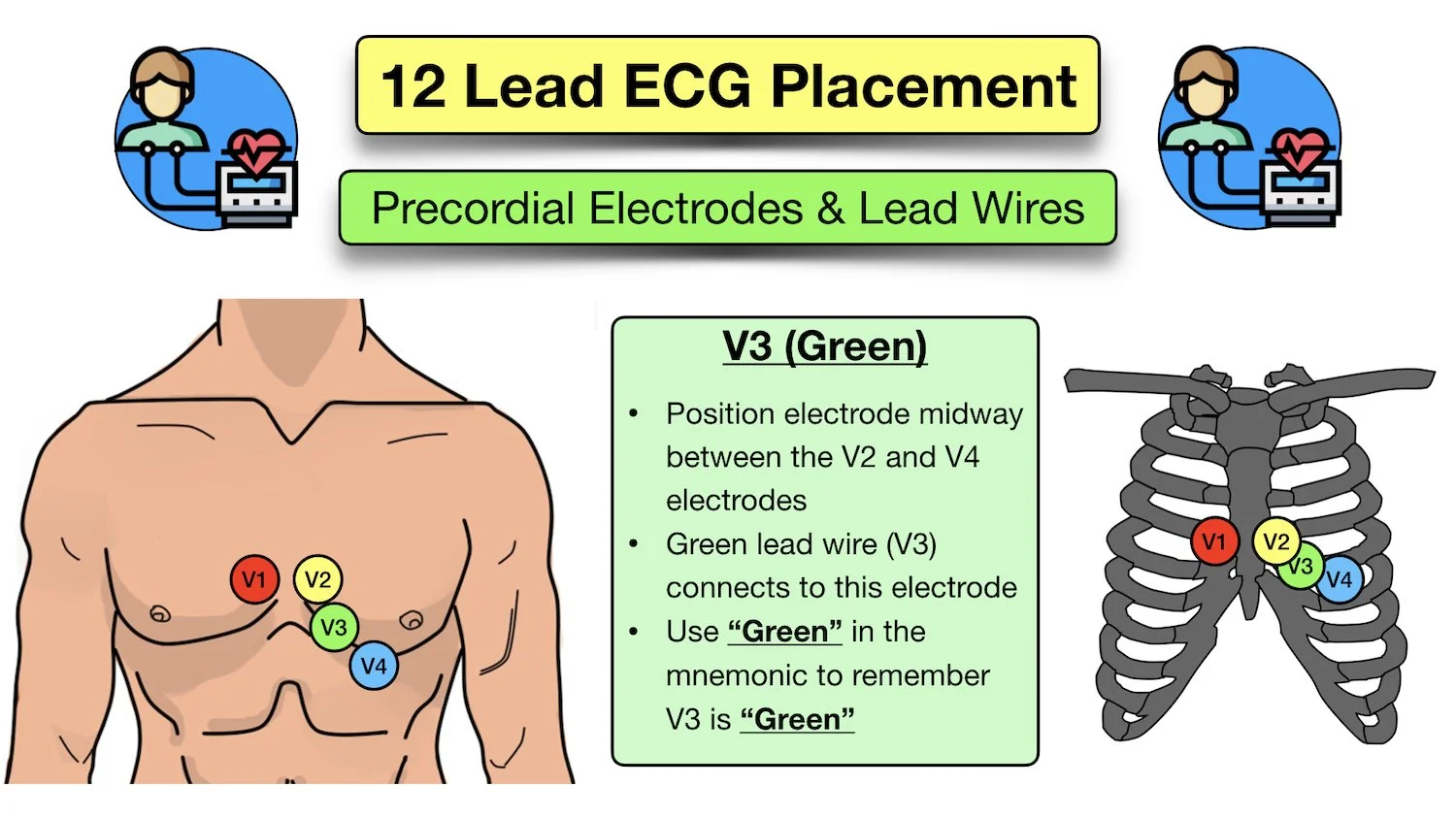 12 lead ecg placement mnemonic ems emt precordial electrode colors location