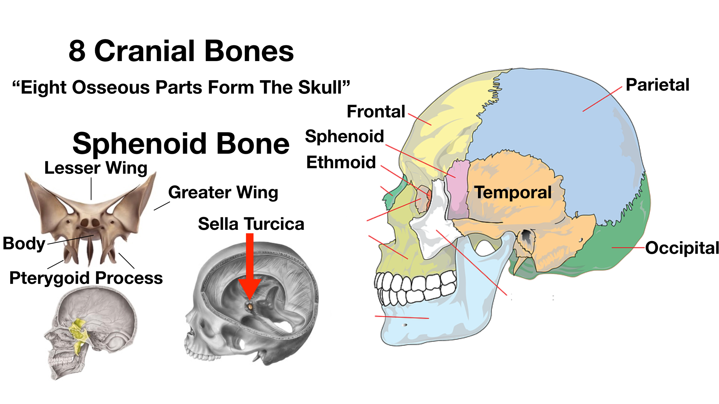Image: The sphenoid bone consists of the greater wing, lesser wing, pterygoid process, and body.