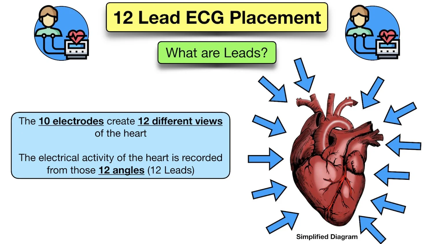 12 lead ecg 10 electrodes wires definition diagram