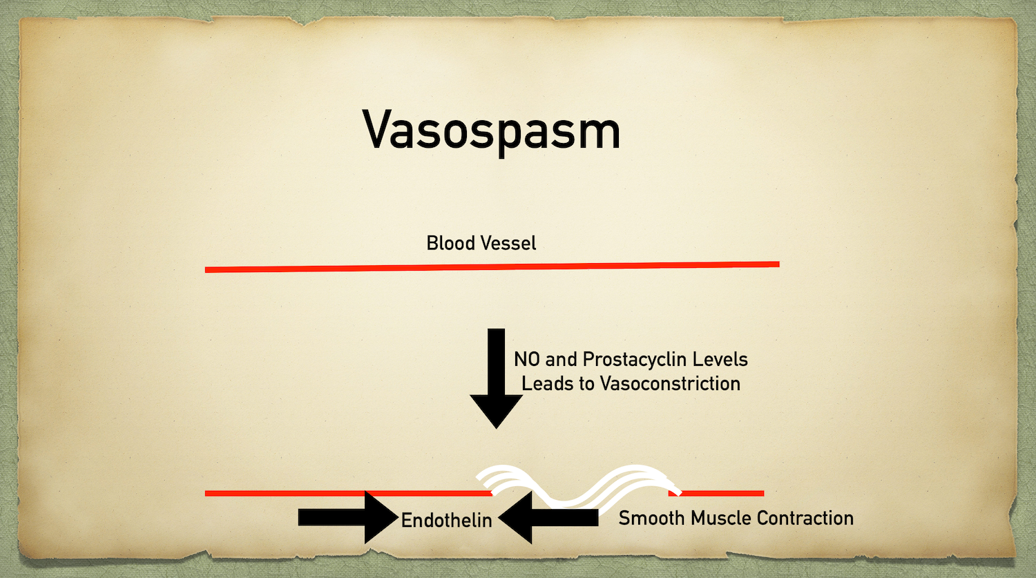 Subendothelial collagen (white) is exposed after injury to the endothelial lining of a blood vessel.Endothelial cells normally release nitric oxide (NO) and prostacyclin to relax blood vessels and prevent platelet activation from occurring. If these…