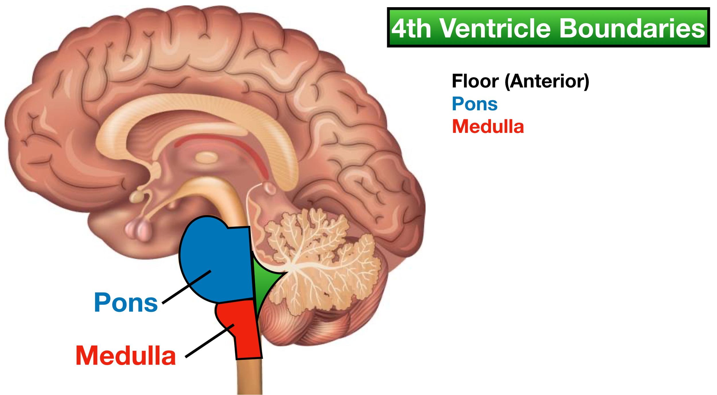 Image (Sagittal View): The floor of the fourth ventricle is formed by the pons superiorly and the medulla inferiorly.