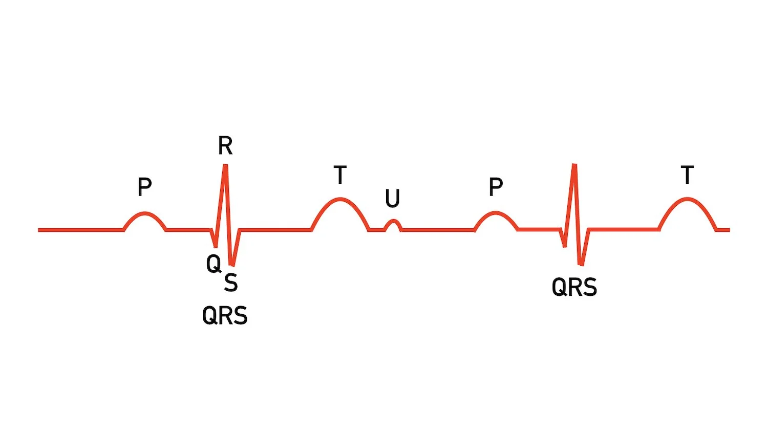 ecg ekg waveform explained labeled components diagram p qrs t u waves