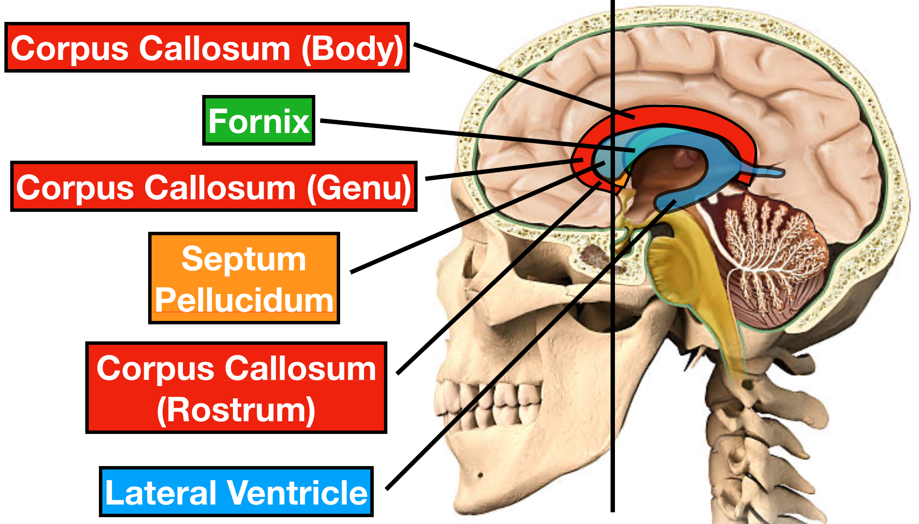Ventricles of the Brain: Anatomy, Function, Labeled Diagram, Location ...