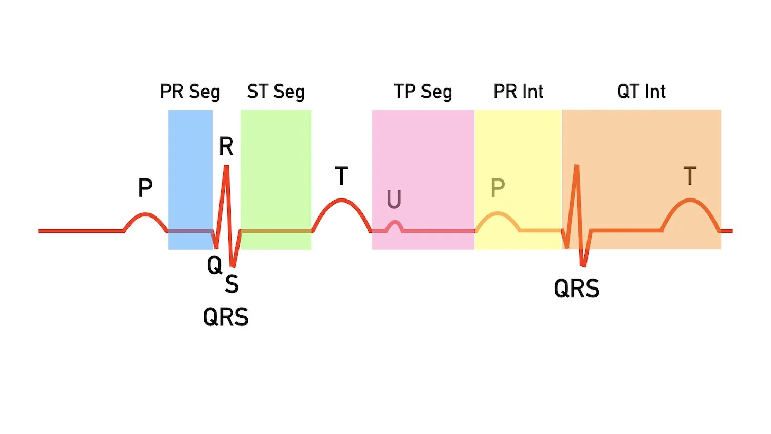 ecg waveform explained labeled components p wave qrs complex t wave