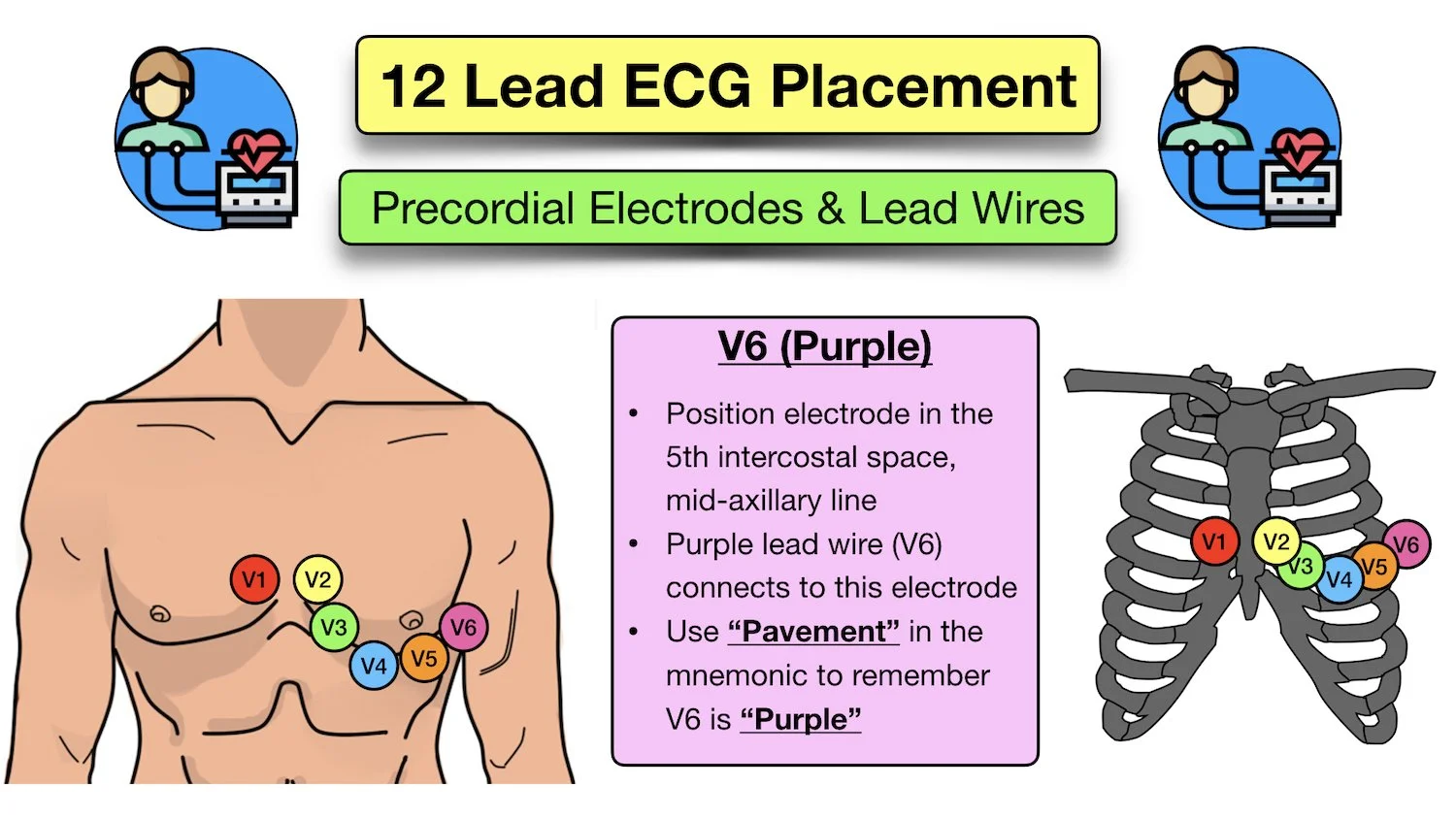 12 lead ecg placement nursing mnemonic emt ems electrode location color diagram