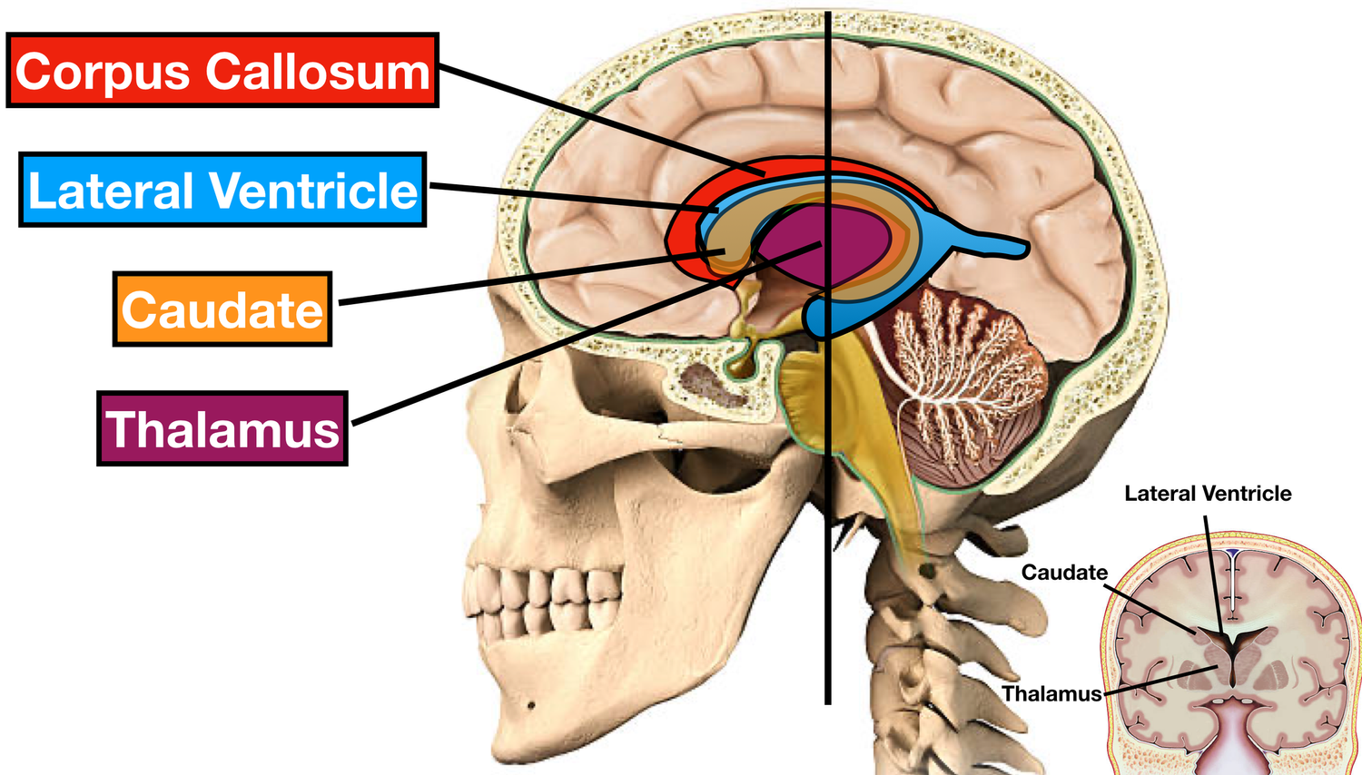 Ventricles of the Brain: Anatomy, Function, Labeled Diagram, Location ...