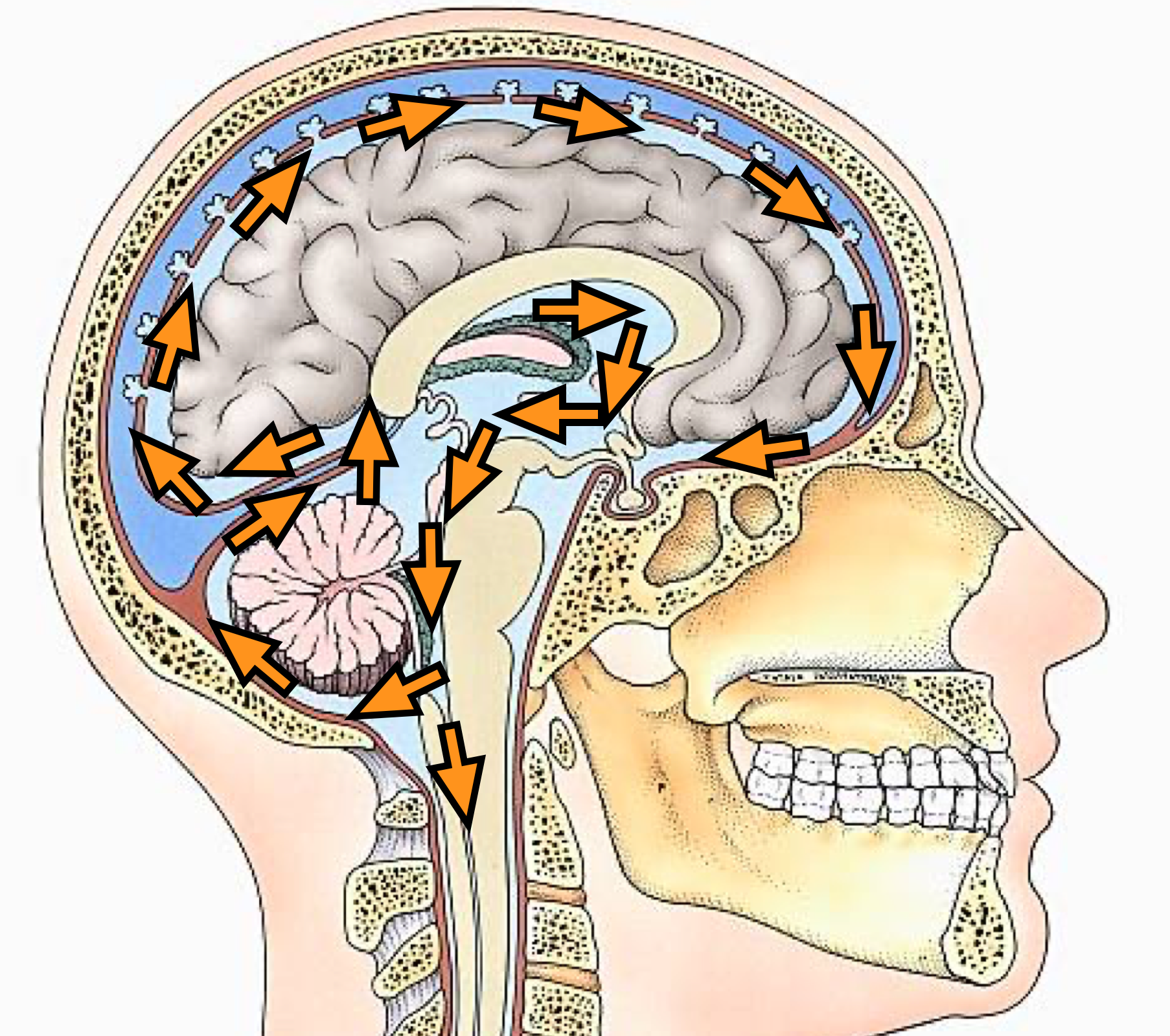Image (Sagittal View): Flow of cerebrospinal fluid (CSF) through the lateral ventricles, interventricular foramina, third ventricle, cerebral aqueduct, fourth ventricle, and subarachnoid space or central canal of the spinal cord.