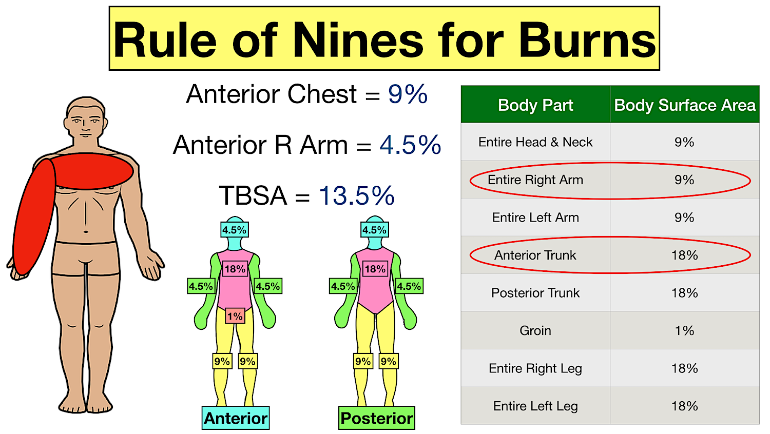 rule of nines for burns example and practice question
