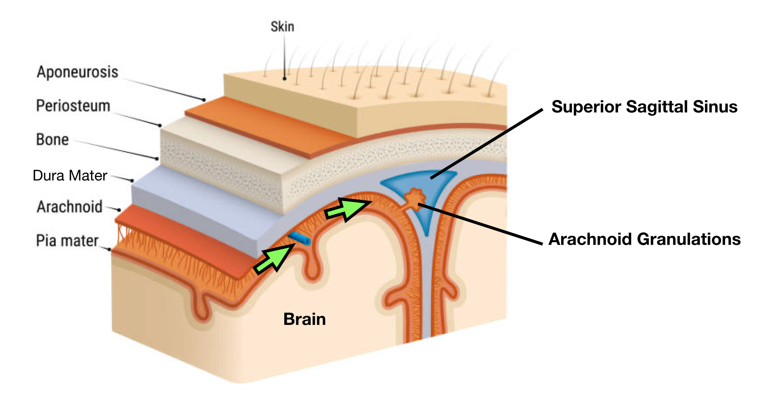 Image: Cerebrospinal fluid (CSF) flows through the subarachnoid space (green arrows) between the arachnoid and pia mater. CSF is reabsorbed into the dural venous sinuses through projections called arachnoid granulations.