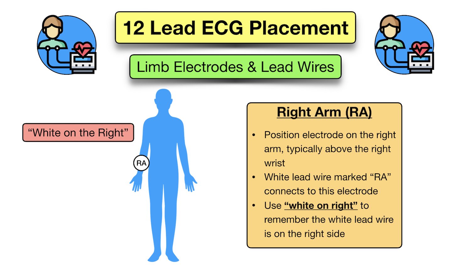 12 lead ecg placement mnemonic limb diagram electrode location