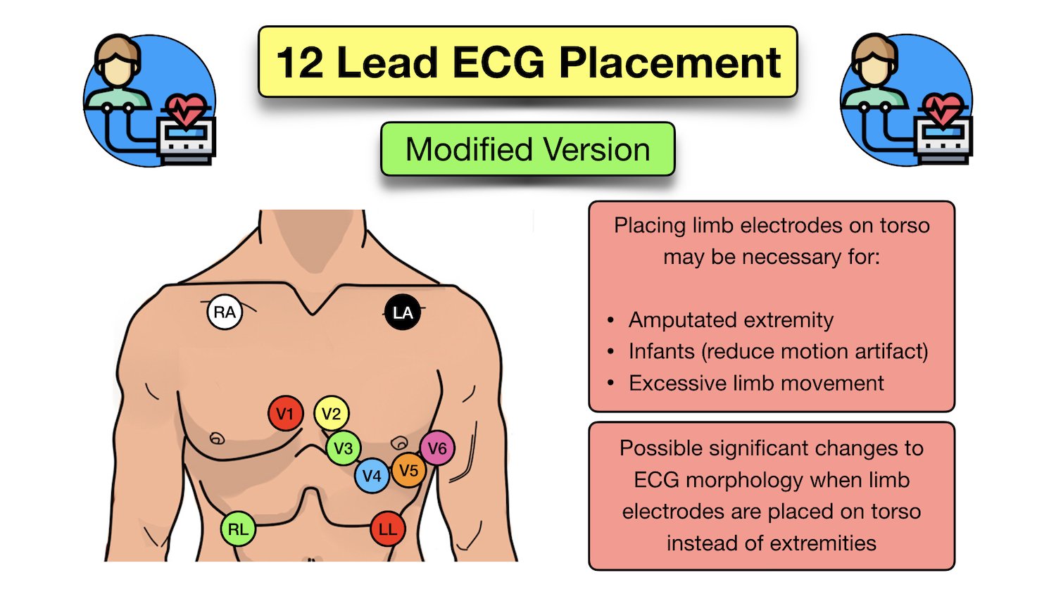 12 lead ecg placement limb precordial electrode location position diagram picture