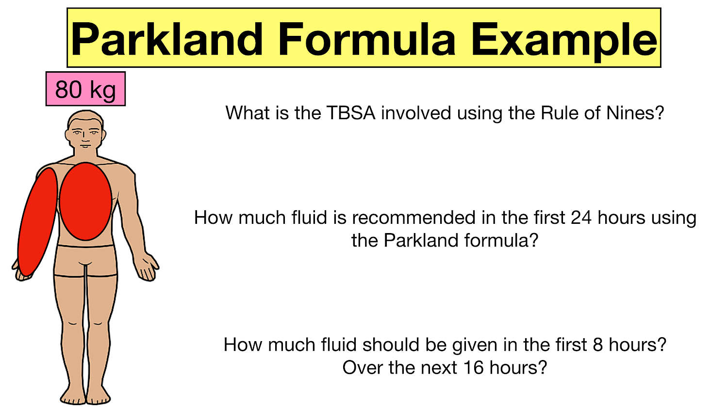 parkland formula burns example practice question