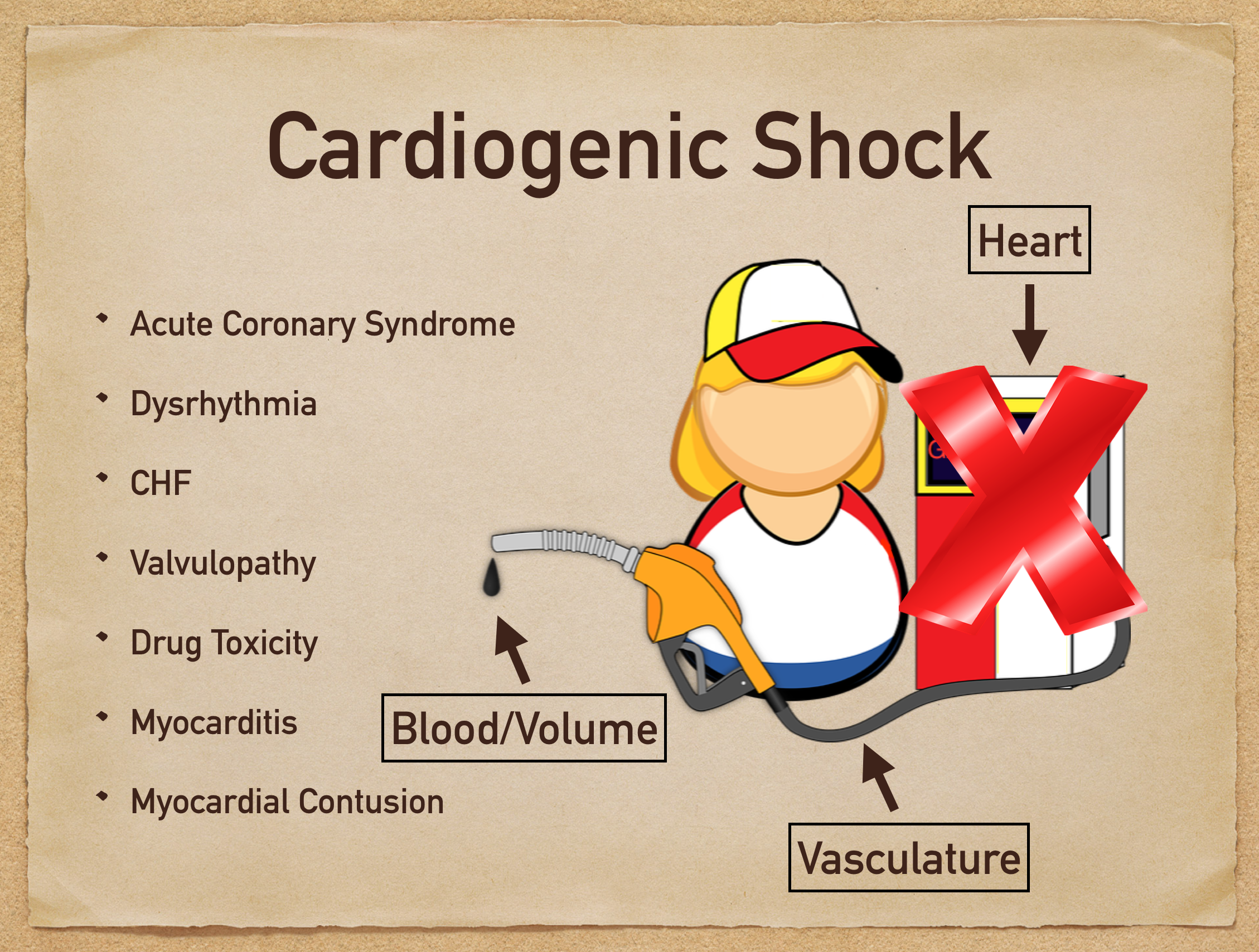 cardiogenic shock