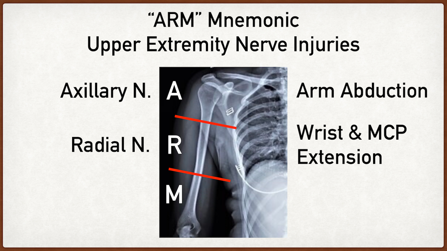 radial nerve injury innervation distribution testing anatomy