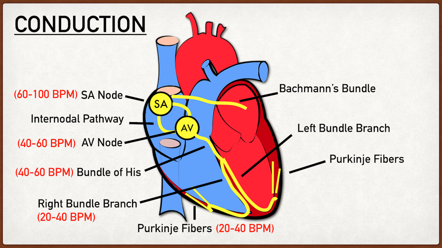 The action potential travels from the bundle branches to the Purkinje fibers, which are the terminal branches throughout the ventricular myocardium. As the action potential disperses through the ventricles, the ventricular myocytes depolarize and co…