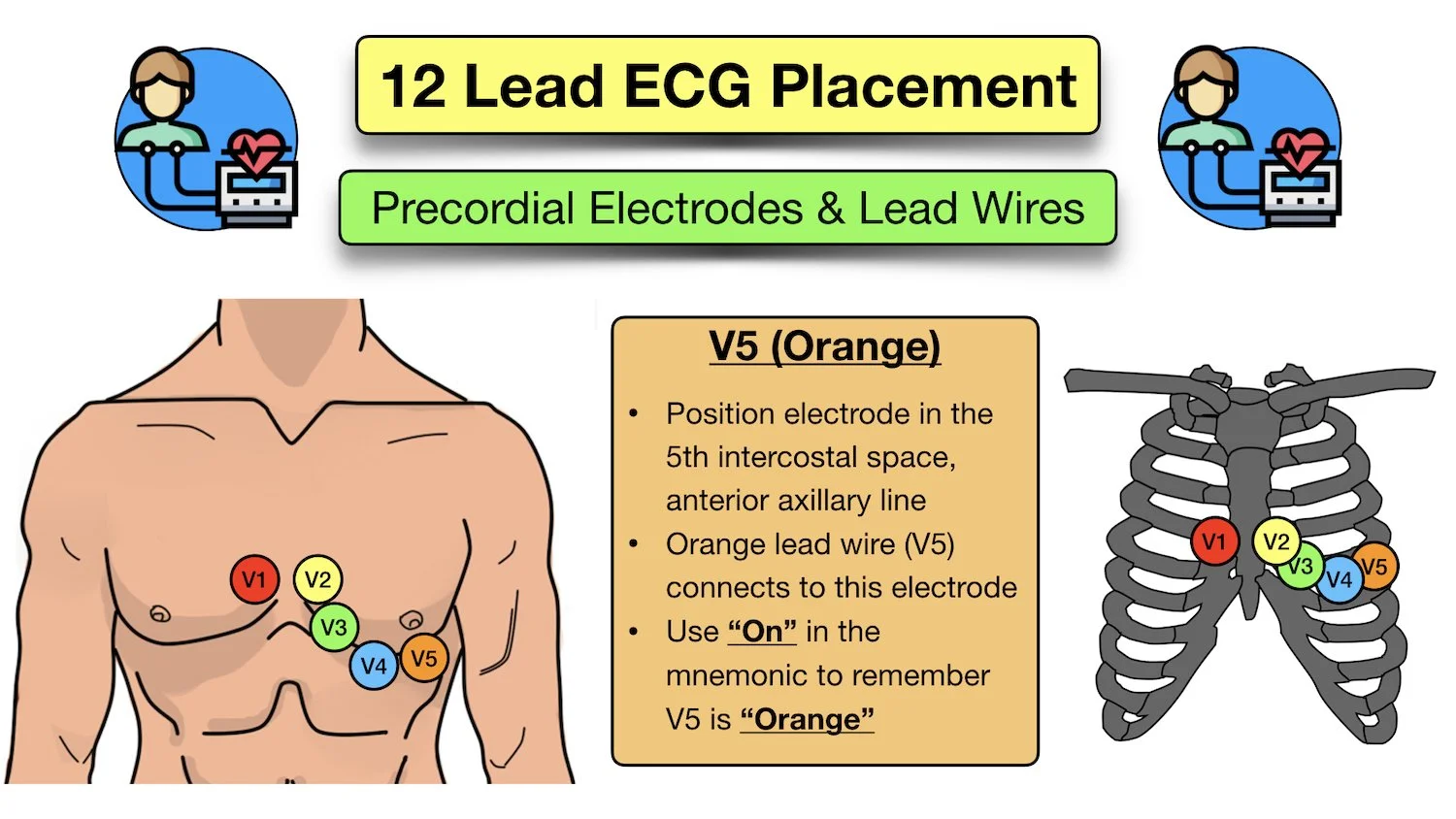 12 lead ecg placement emt ems mnemonic precordial electrode location color