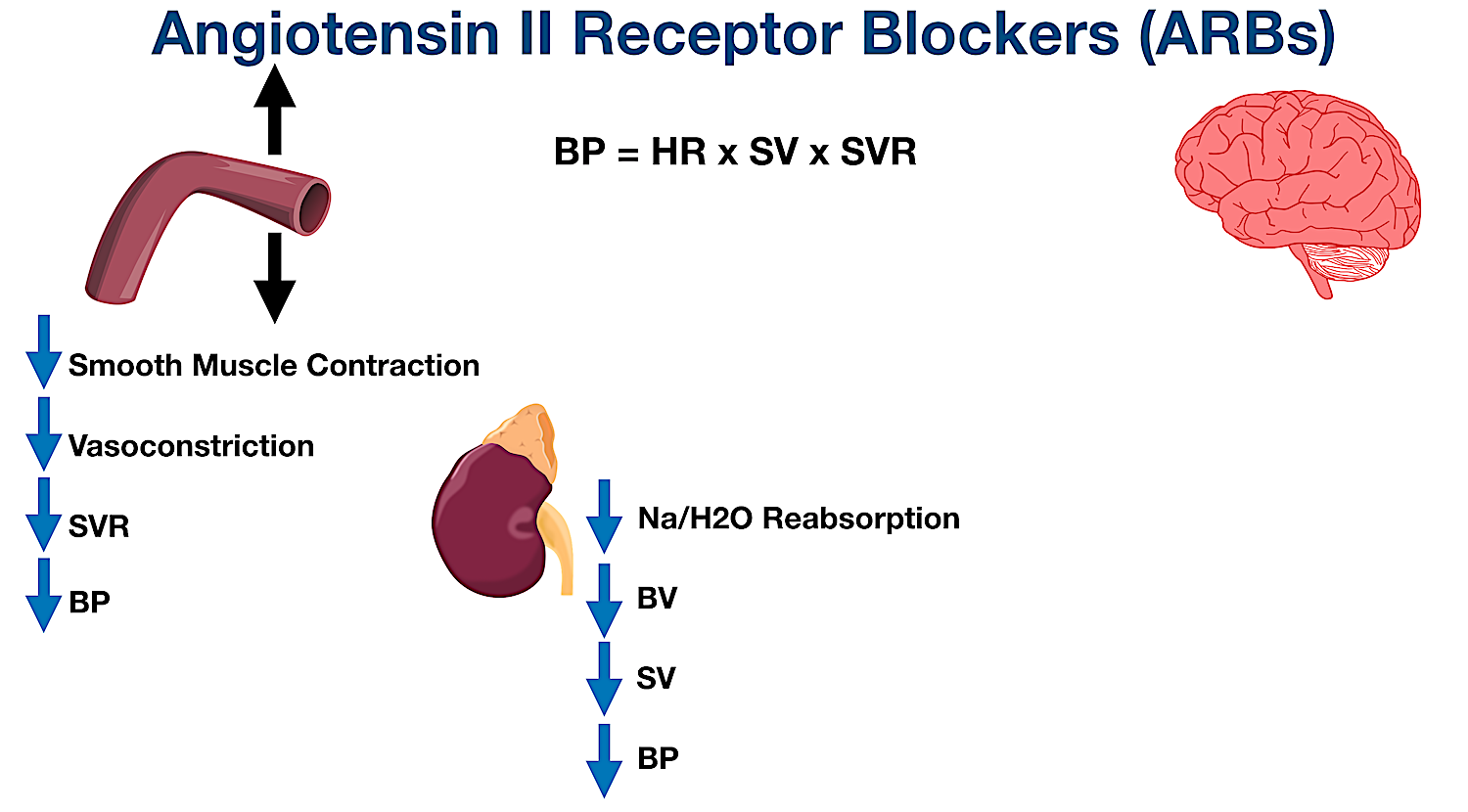 Blocking angiotensin II receptors with an ARB results in decreased sodium and water reabsorption in the proximal tubule of the nephron. This decreases blood volume (BV), stroke volume (SV), and blood pressure (BP).