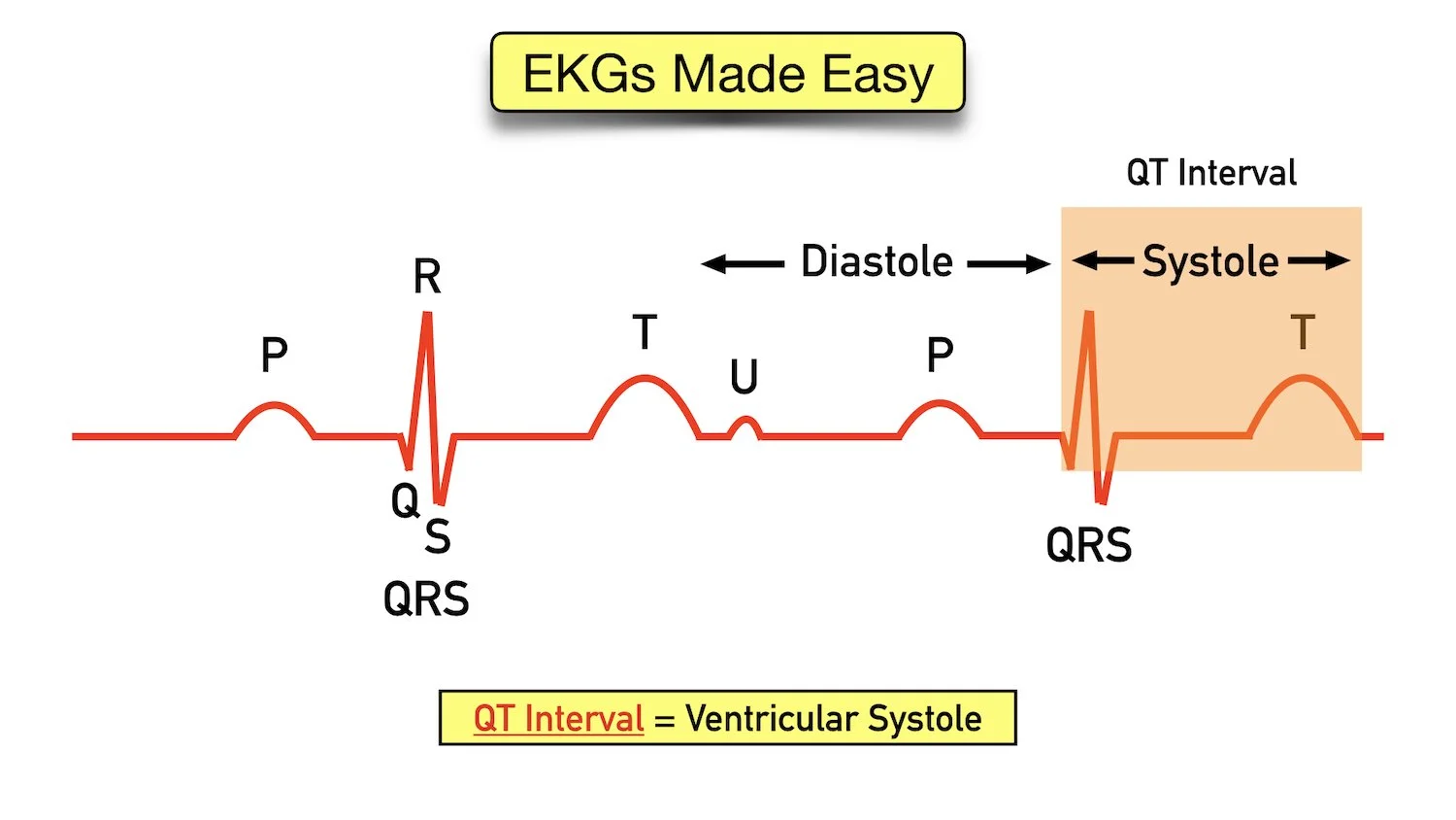 ecg waveform explained qt interval systole ventricular depolarization repolarization
