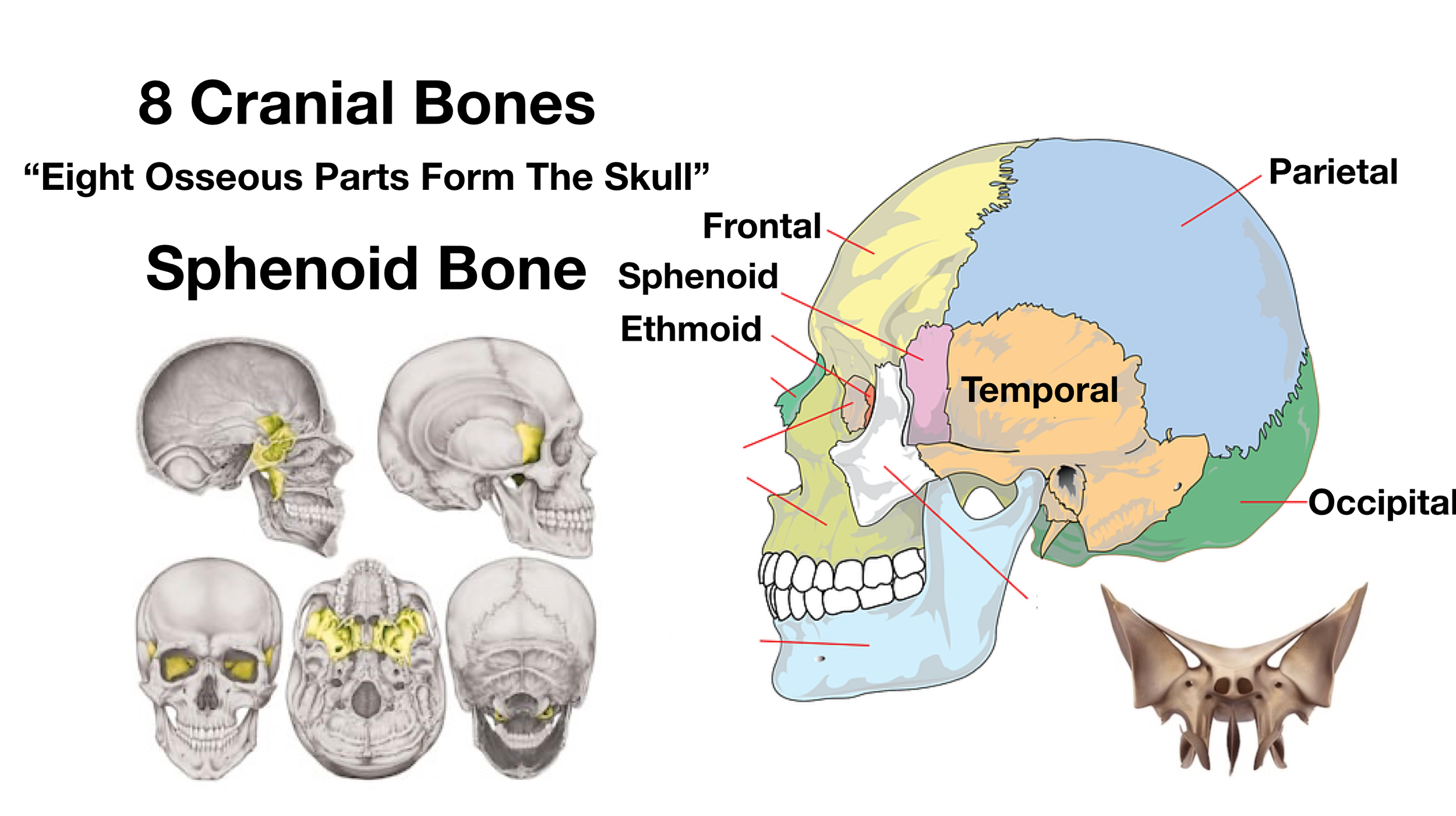Image: The sphenoid bone is shaped like a butterfly as shown in the bottom right. Other images of the skull show the sphenoid bone highlighted in yellow.