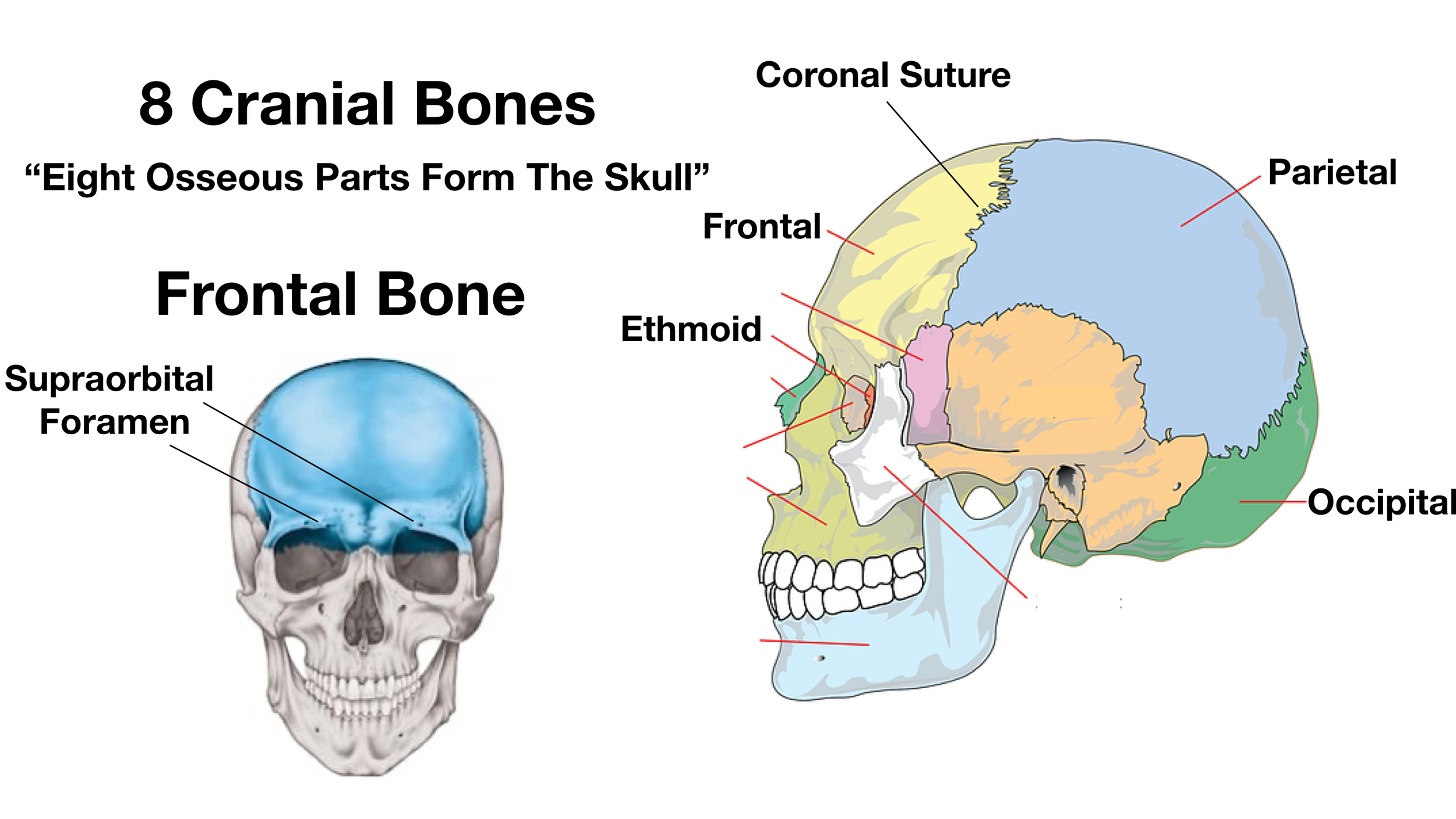 Image: The frontal bone is the forehead. It connects to the parietal bones via the coronal suture. There is a supraorbital foramen above each orbit in which the supraorbital nerve travels through.