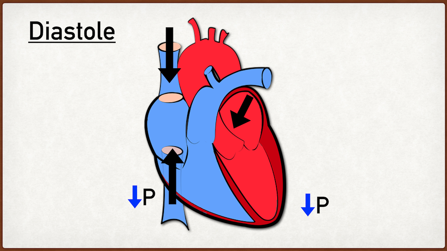 Image: The ventricles are in a low pressure (P) state during early diastole as they are relaxed and not contracting. The low pressure augments blood flow into the heart. Venous blood from the body enters the right atrium via the SVC and IVC. Blood f…