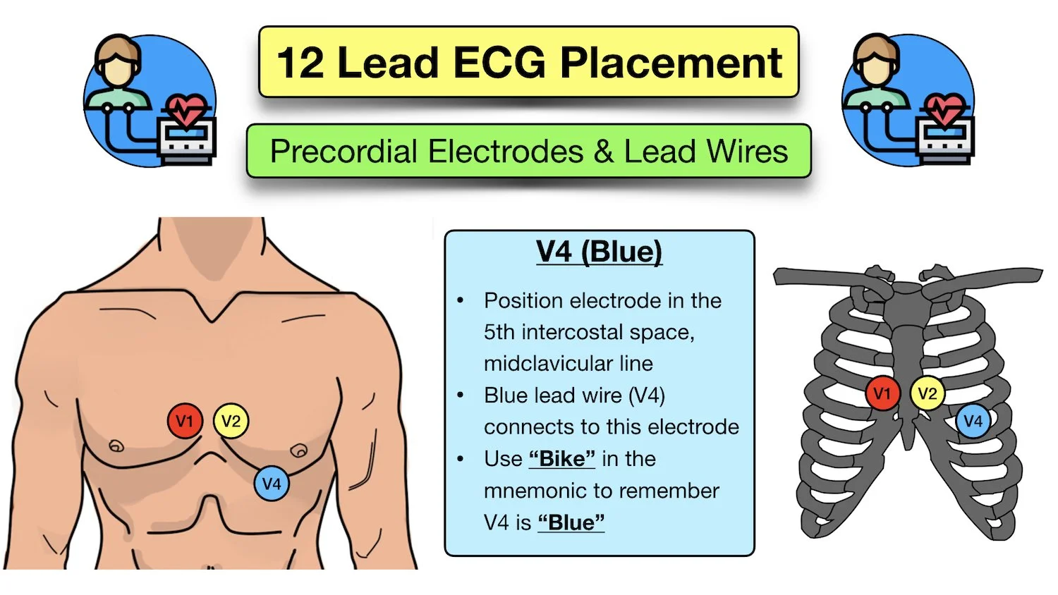 12 lead ecg placement mnemonic emt ems precordial electrode diagram location colors