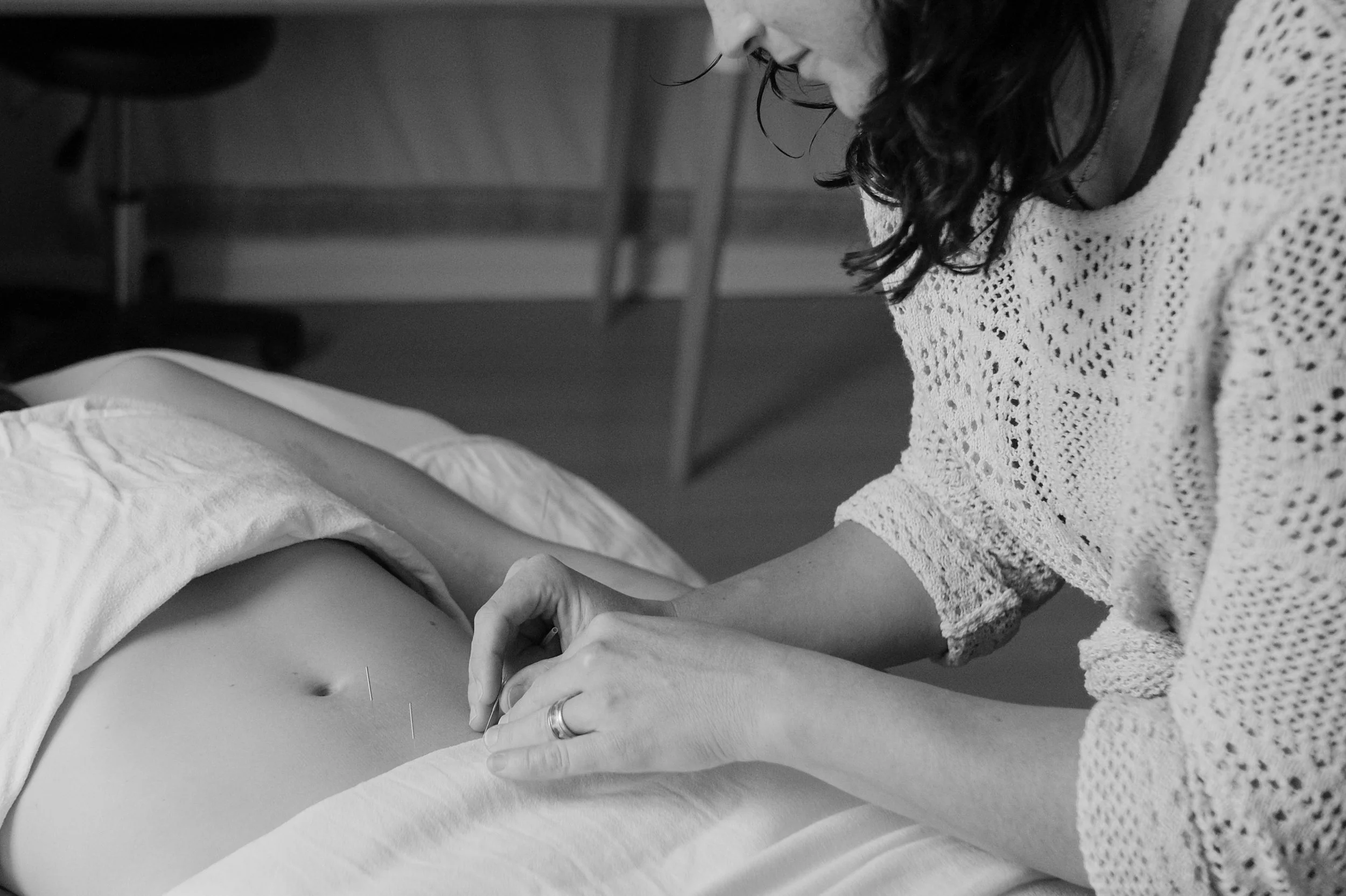 A woman receiving acupuncture treatment on her abdomen in a clinical setting.