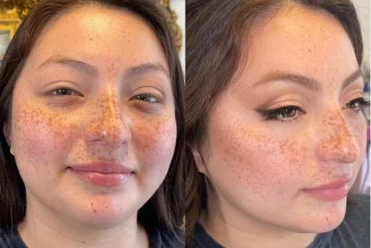 before and after 4.jpg