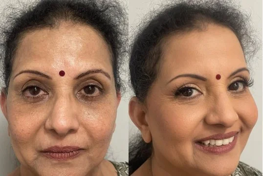 before and after 1.jpg