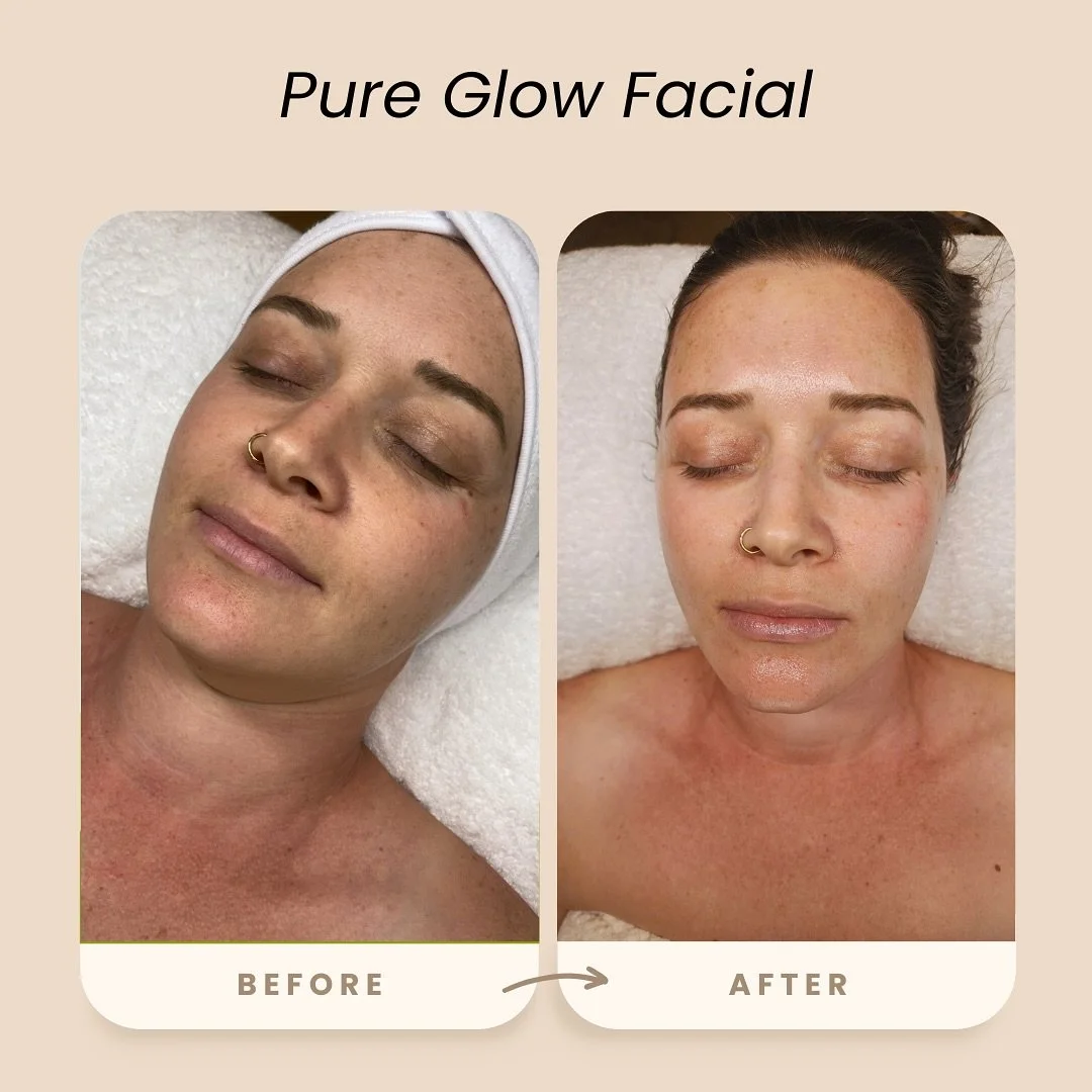 Sneak peek alert! 👀✨ 

Check out this amazing before and after of my dermaplaning facial! The glow is REAL! 😍 I&rsquo;ve got a short video coming soon, but here&rsquo;s a little teaser to show you just how transformative it is. Stay tuned - your sk