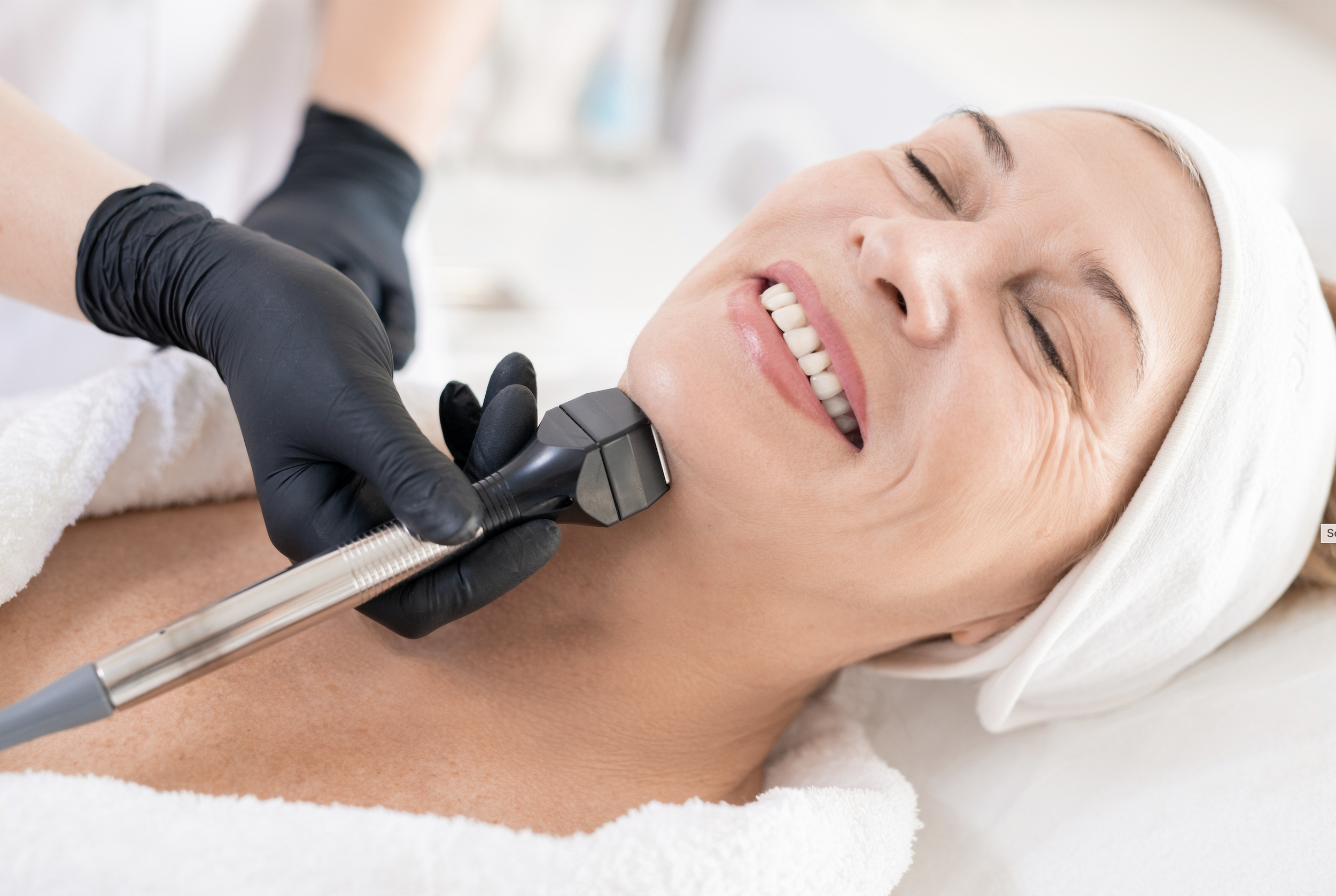 Skin Tightening