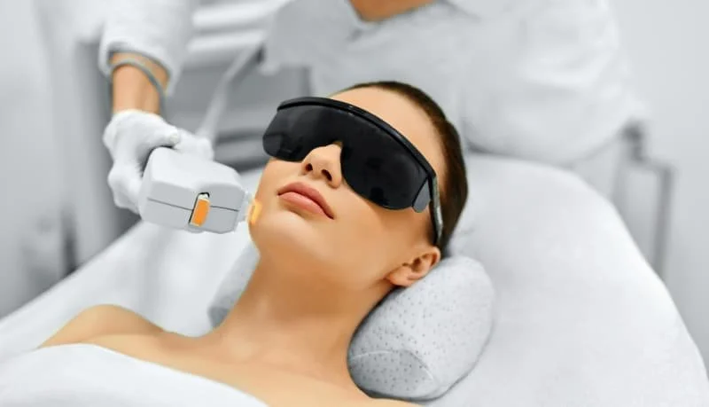 ipl-laser.jpg
