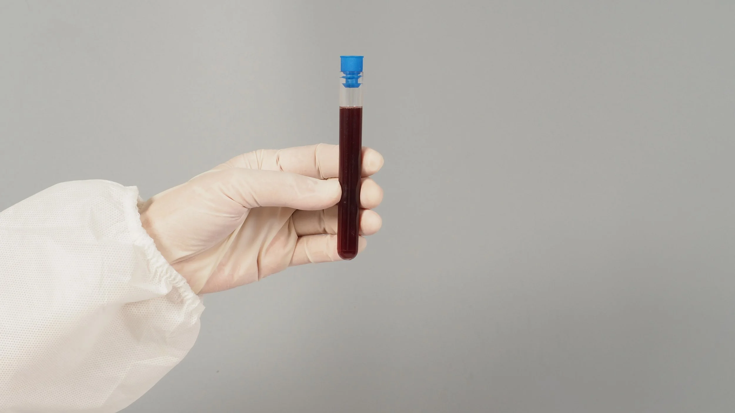 gloved-hand-holding-a-vial-of-blood-2026-01-09-00-16-02-utc.jpg