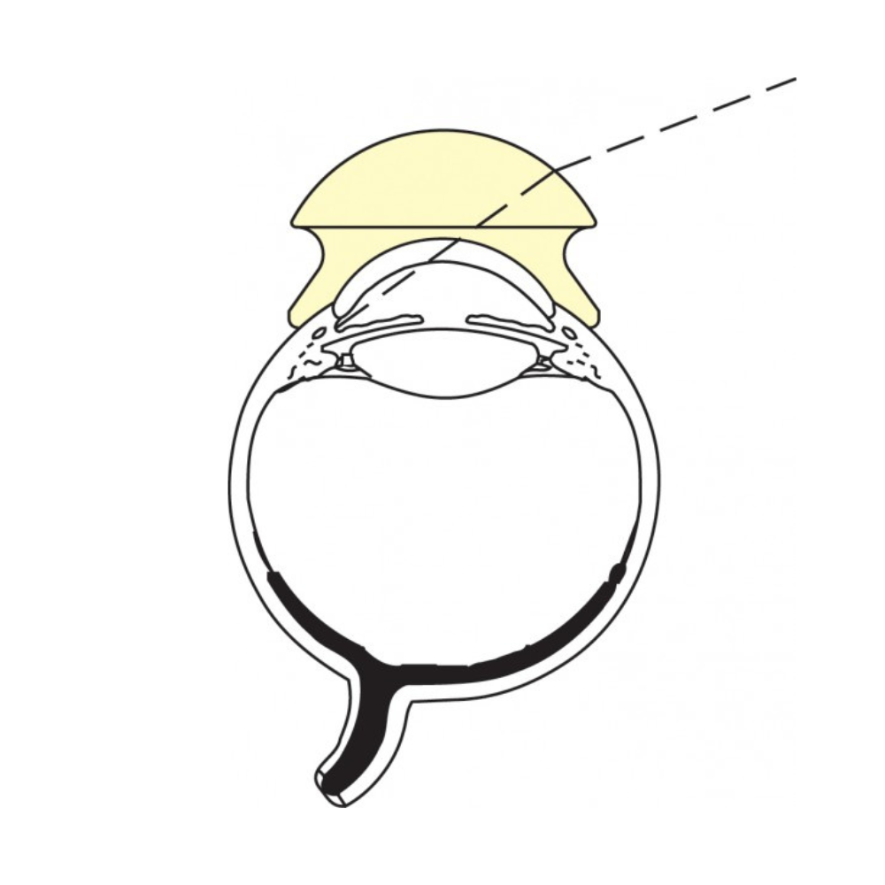 Plantilla Web 1000X 1000.png