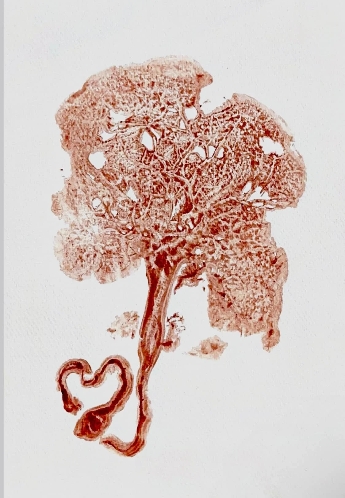 Flawless Placenta Print